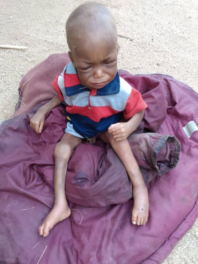 الموت يحاصر نازحي معسكر مكجر بولاية وسط دارفور